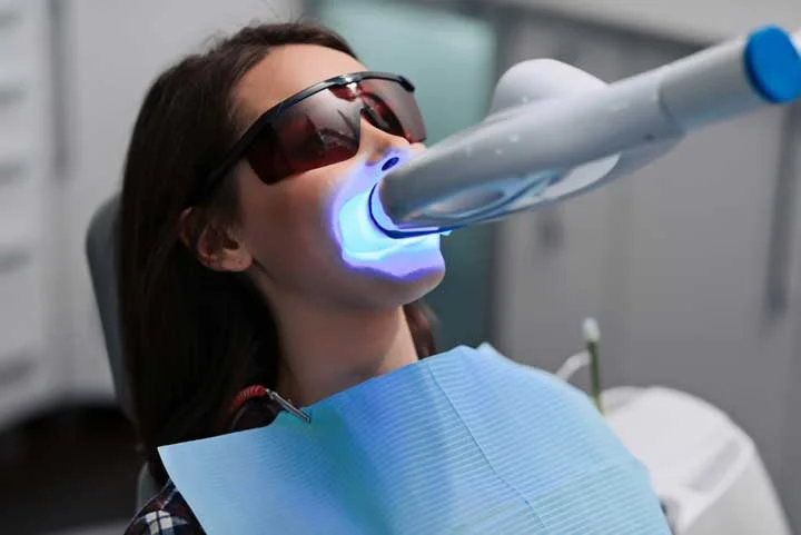 Laser Teeth Whitening Process